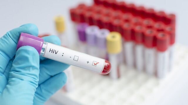 احتمال تحقق واکسن ایدز به‌زودی
