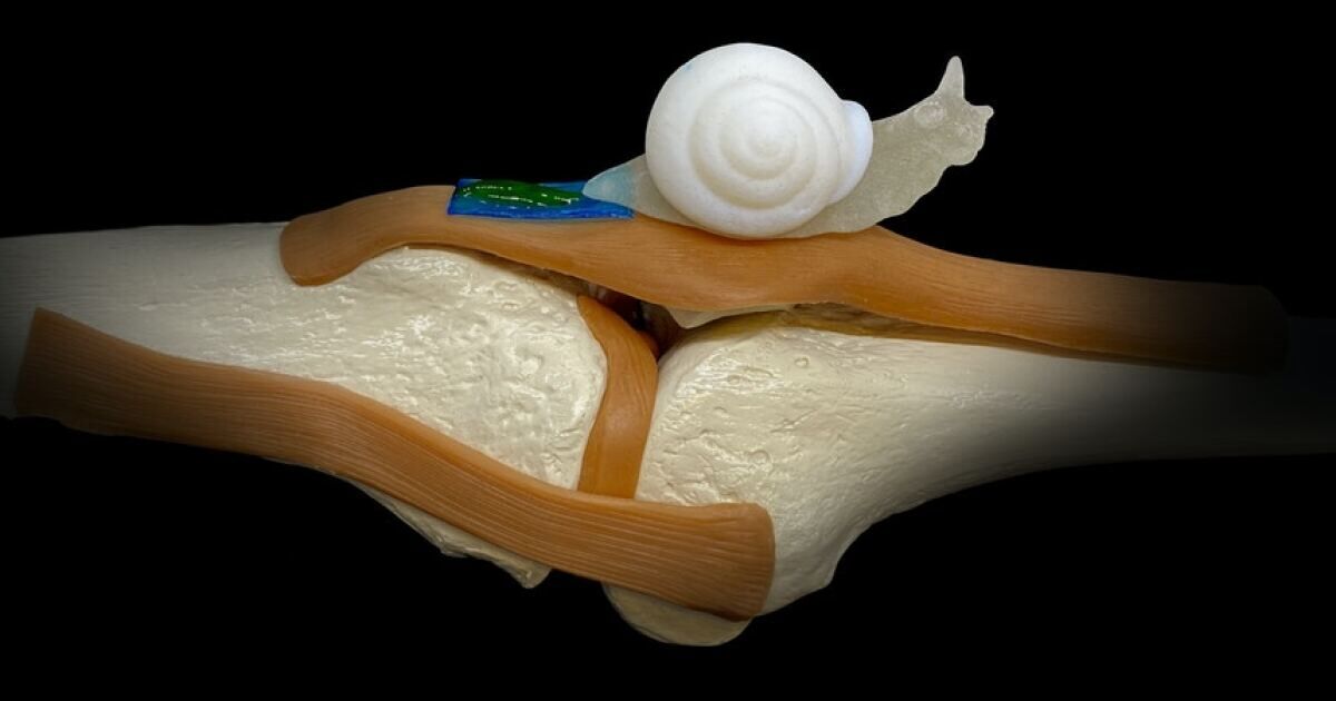 تولید ترکیبات زیستی برای درمان تاندونهای آسیب دیده تولید ترکیبات زیستی برای درمان تاندونهای آسیب دیده