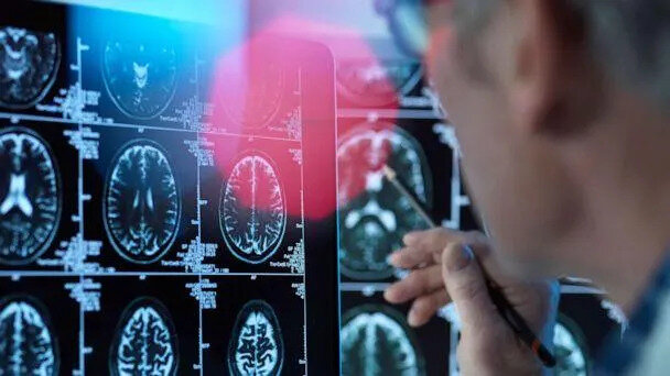 حقیقت یا شایعه/ آیا ویدئوهای کوتاه واقعاً مغز را دچار زوال میکنند؟