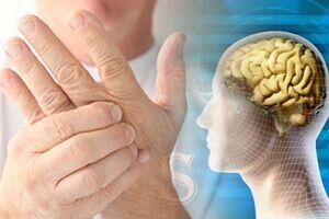 ام اس، محصول استرس و تغییر سبک زندگی