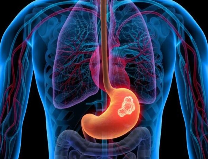 چکاپهای ضروری برای زنان بالای 35 سال کدامند؟