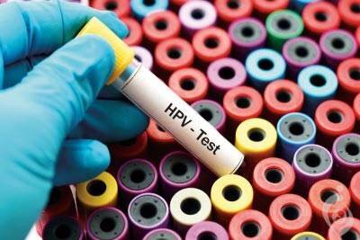 چکاپهای ضروری برای زنان بالای 35 سال کدامند؟