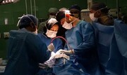 نخستین عمل جراحی صرع با موفقیت در مشهد انجام شد
