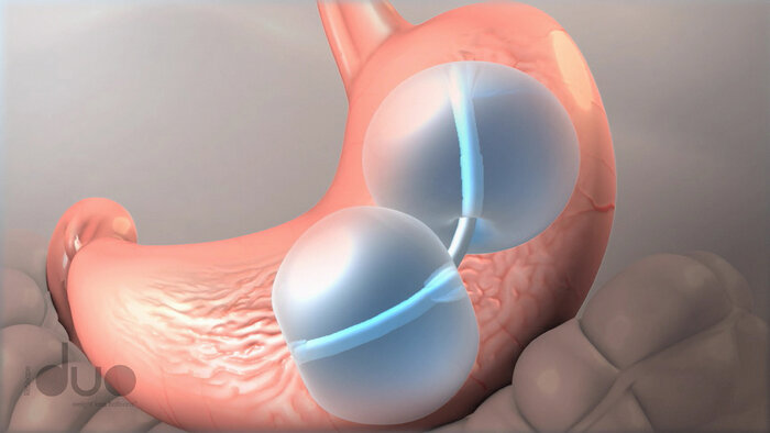 رژیمهای فوری؛ آژیر قرمز شروع بیماری