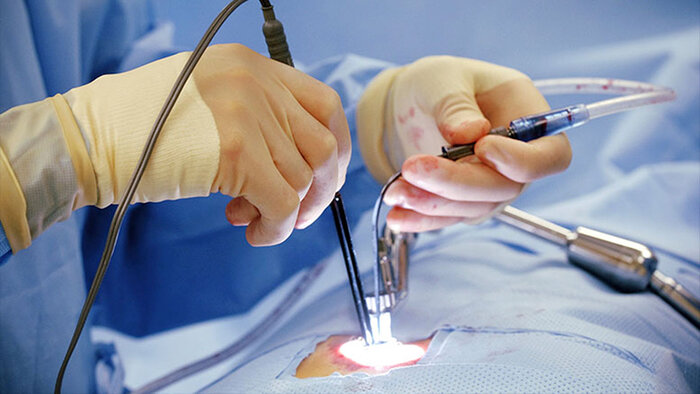 چه جایگزین هایی برای جراحی دیسک کمر وجود دارد؟