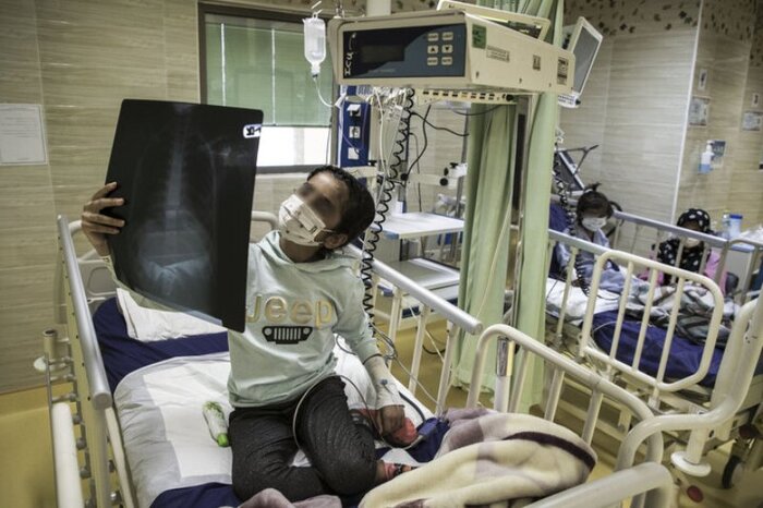 امتناع در واکسیناسیون کودکان؛ پاشنه آشیل مهار  اومیکرون در مازندران