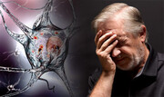 زنگ خطر کاهش سن ابتلا به آلزایمر