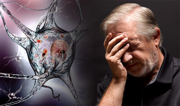 آلزایمر بیشتر در افراد بالای ۶۵ سال دیده می شود آلزایمر بیشتر در افراد بالای ۶۵ سال دیده می شود