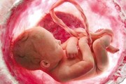بیش از ۹۵ درصد جنین های سقط شده کشور سالم بودند