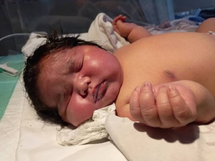 نخستین نوزاد ۶ کیلو و ۵۰۰ گرمی امسال به روش زایمان طبیعی در مشهد متولد شد