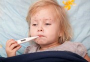 واکسیناسیون جهانی متاثر از شیوع کرونا/ده‌ها میلیون کودک در خطر ابتلا به سرخک هستند