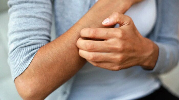 این چهار تغییر پوستی نشان میدهد کبد بیماری دارید