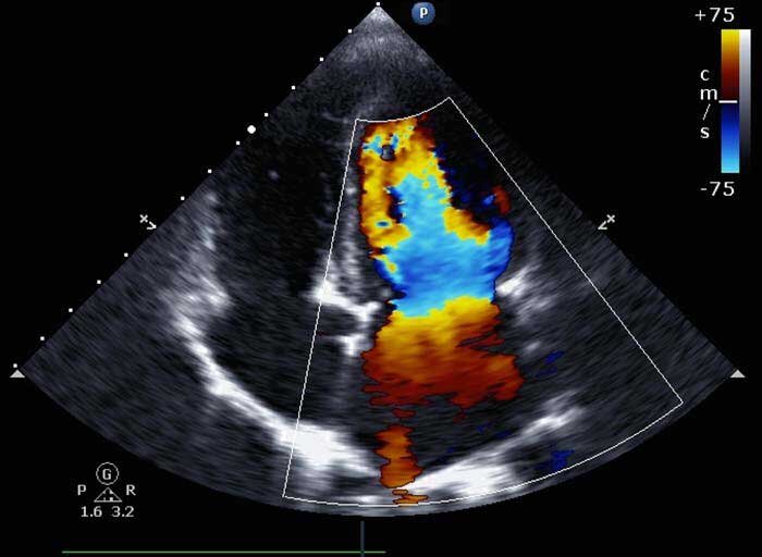 همه چیز درباره سونوگرافیهای دوران بارداری
