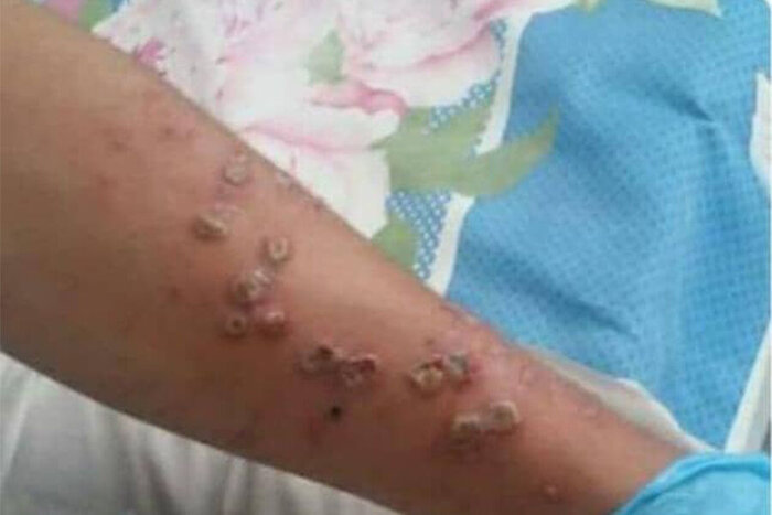 از رفع موانع تجارت ایران و پاکستان تا شناسایی آبله میمون در افغانستان