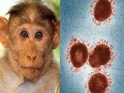 اولین مورد آبله میمون در عربستان سعودی شناسایی شد