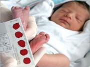 ۹۸ درصد نوزادان تحت پوشش دانشگاه علوم پزشکی مشهد غربالگری بدو تولد شدند