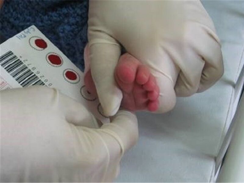 ۲۰ مرکز خدمات جامع سلامت درشهرستان ری خدمات غربالگری نوزاد ارائه میدهد ۲۰ مرکز خدمات جامع سلامت درشهرستان ری خدمات غربالگری نوزاد ارائه میدهد