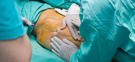 خطرناکترین جراحیهای زیبایی