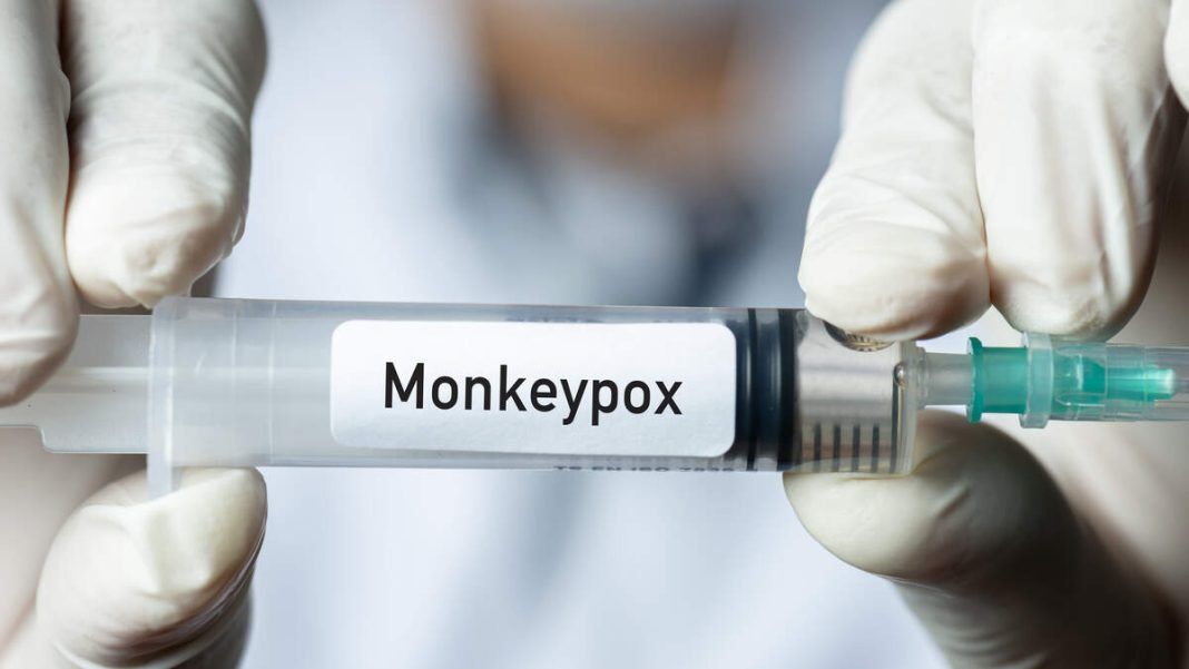  وجود بیش از ۱۸ هزار مبتلا به آبله میمون در جهان 