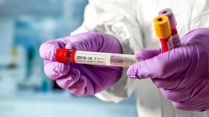 بازگشت کرونا به آسیای مرکزی