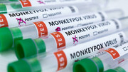 پرهیز بیماران آمریکایی از درمان به خاطر نام آبله میمون
