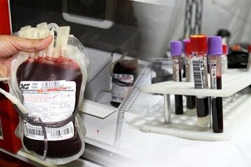 مراکز انتقال خون استان سمنان با ۹ میلیارد تومان در دولت سیزدهم بهسازی شد