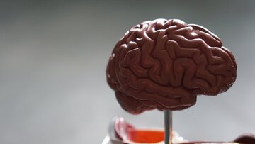 تصویربرداری پیشرفته مغز با هوش مصنوعی و یادگیری عمیق