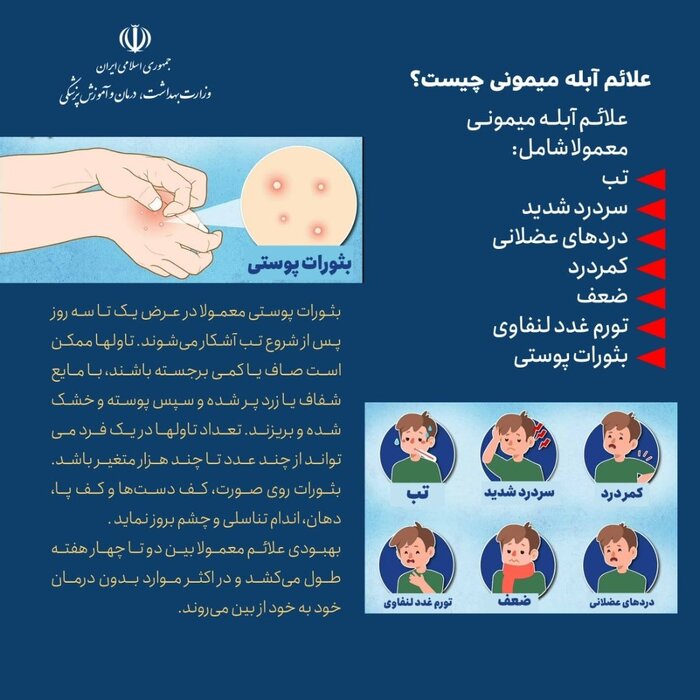 آبله میمونی کشنده نیست/ از تماس با حیوانات خودداری کنید
