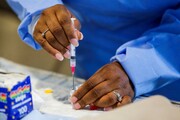 سوئیس دارو و واکسن ضد ویروس آبله تولید می‌کند 