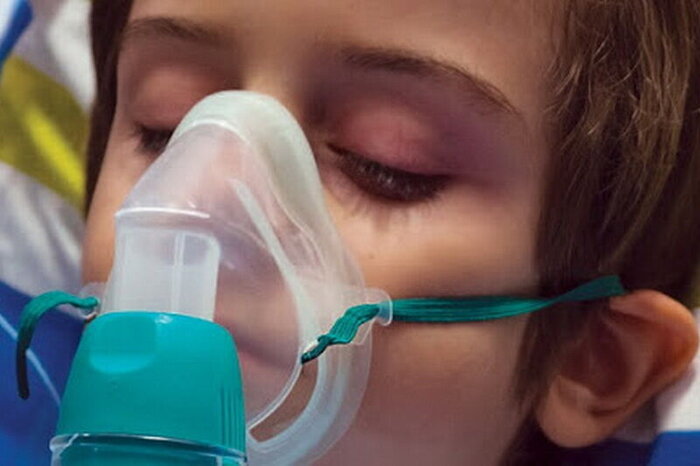 یونیسف ۳۵ دستگاه نبولایزر به بیماران مبتلا به سیاف کرمانشاه اهدا کرد