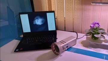 فناوران ایرانی دستگاه «تصویربرداری حین جراحی» را بومی سازی کردند