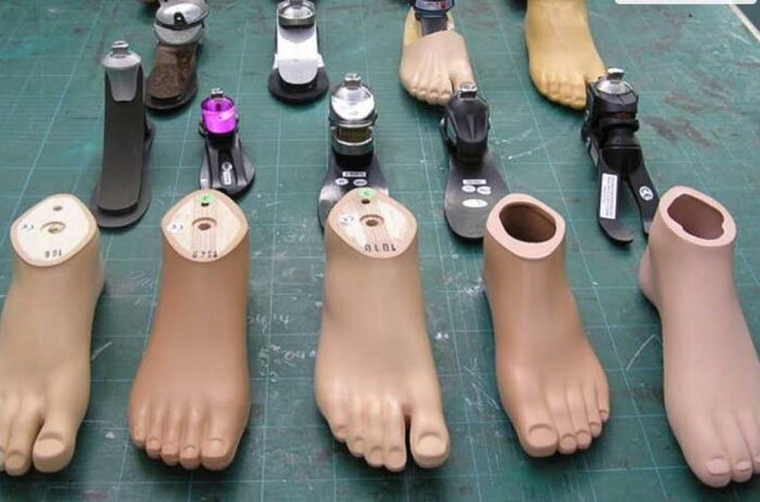 پیگیریهای خبرنگار ایرنا به نتیجه رسید؛ مفصل پای مصنوعی جانباز معترض تعویض شد