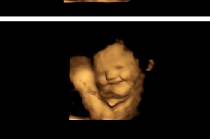 جنین در رحم مادر به مزه و بو واکنش نشان میدهد