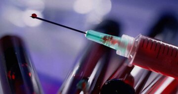 آزمایش موفقیت‌آمیز واکسن نانویی ضدایدز روی موش‌ها