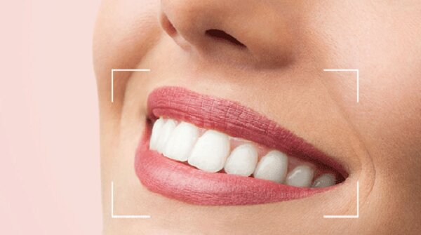 همهچیز درباره لبخندهای هالیوودی