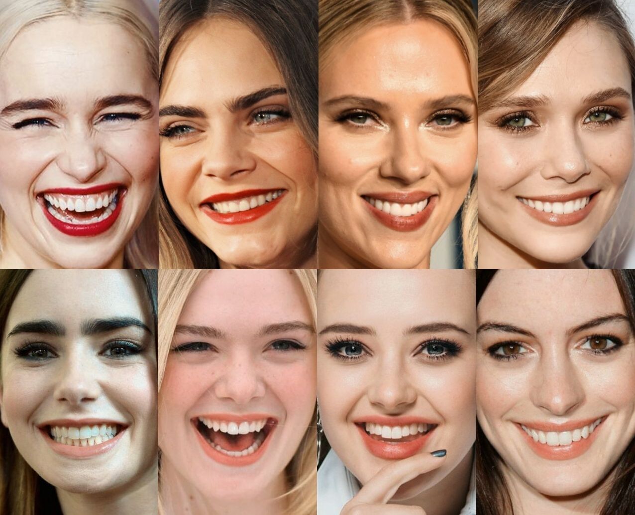 همهچیز درباره لبخندهای هالیوودی همهچیز درباره لبخندهای هالیوودی