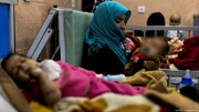 رشد ۴۷ درصدی سوء تغذیه بین کودکان افغانستان