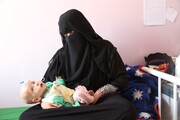 روزانه ۸۰ نوزاد در یمن می میرد