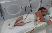 جنایات پنهان سعودیها؛ ناهنجاری های مادرزادی کودکان یمنی
