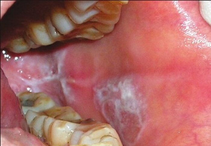 ارزان میفروشند؛ شیره جان میکِشند