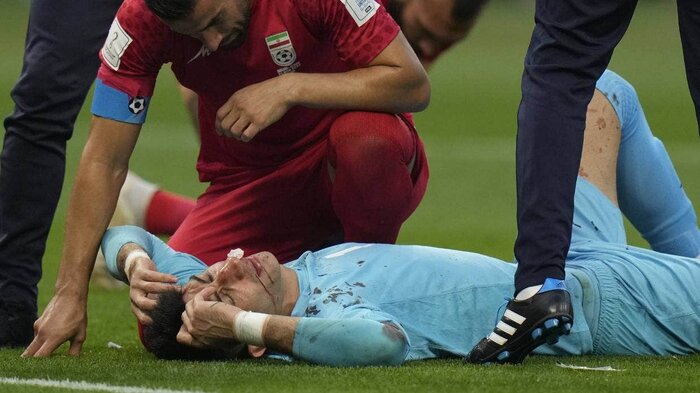 خنثیسازی مینگذاری بیبیسی در نشست خبری و چشم امید ایران به ساق یوزها