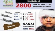 خلال 2800 يوم من العدوان على اليمن.. استشهاد وجرح اكثر من 47 ألفا بينهم 8800 طفل