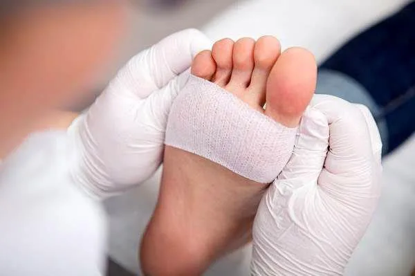 کشف مادهای جدید که به بهبود سریع زخمهای دیابتی کمک میکند