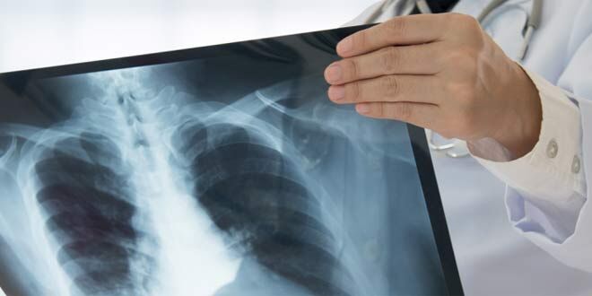 پیشبینی خطر ابتلا به بیماری قلبی با هوش مصنوعی پیشبینی خطر ابتلا به بیماری قلبی با هوش مصنوعی