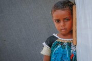یونیسف: ۱۵ کودک یمنی بر اثر ابتلا به سرخک جان باختند