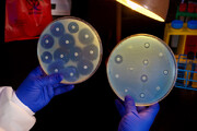ردیابی گسترش جهانی مقاومت باکتری‌ها در برابر آنتی‌بیوتیک 