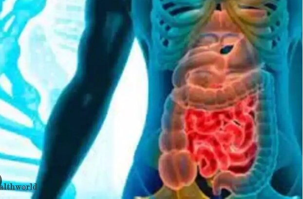 تشخیص دقیق سرطان روده با هوشمصنوعی و تصویر مادون قرمز