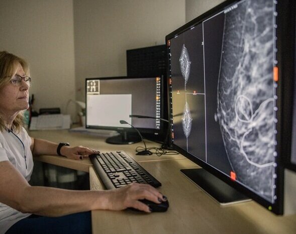 هوش مصنوعی به تشخیص سرطان سینه کمک می‌کند