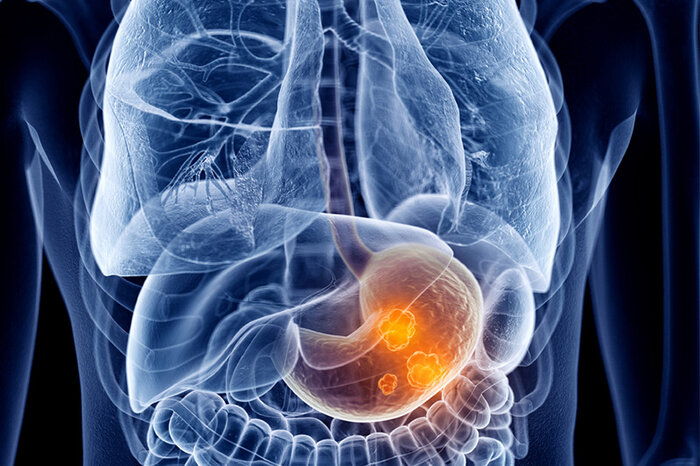 چرا نهنگها کمتر به سرطان مبتلا میشوند 2 راهی به درون اسرار پزشکی/چرا نهنگها کمتر به سرطان مبتلا میشوند