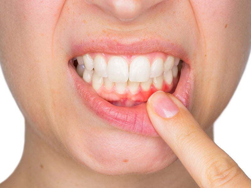 مسواک نزدن و این همه عوارض